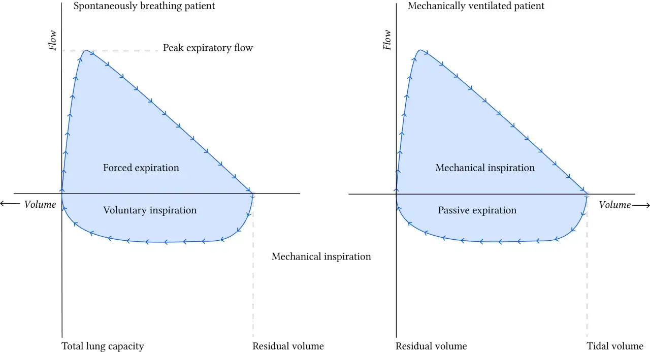 Fluss-Volumen-Kurven für spontan atmende und mechanisch beatmete Patienten. Der fev1 wert ist ein wichtiger Parameter zur Beurteilung der Lungenfunktion.