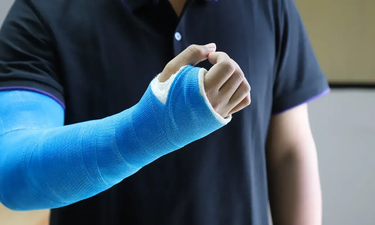 Ręka w niebieskiej ortezie, która wygląda jak gips, po urazie.