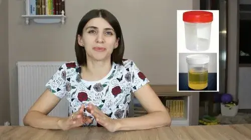 Pobieranie moczu metodą clean-catch u niemowlaka
