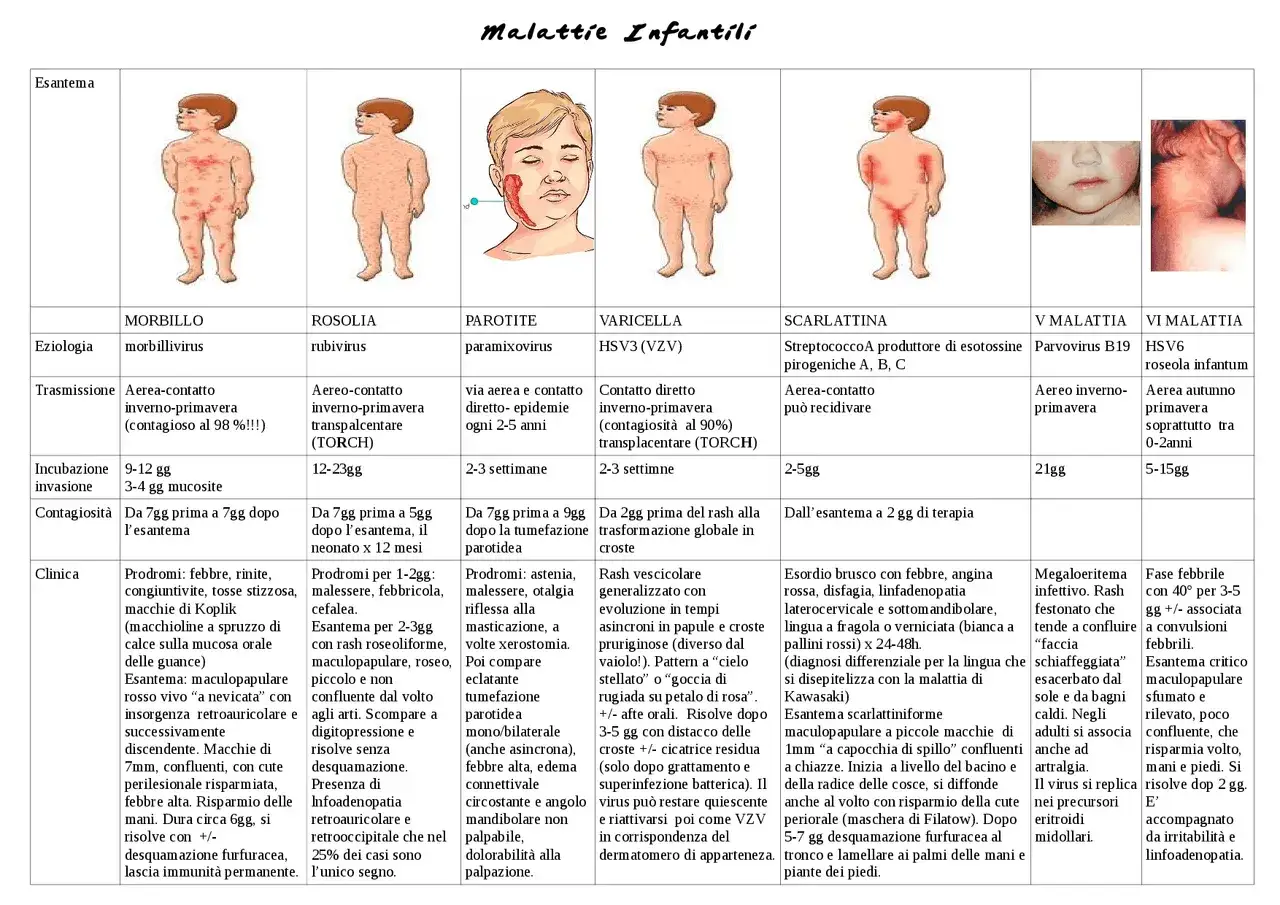 Bambino con esantema, sintomo della quarta malattia. La tabella confronta morbillo, rosolia, parotite, varicella, scarlattina, V e VI malattia.