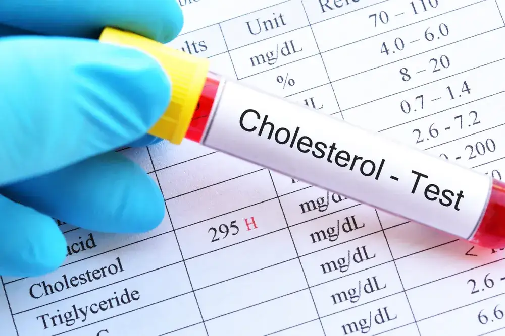 Zdjęcie Jakie badanie na cholesterol wybrać, aby zadbać o zdrowie serca?