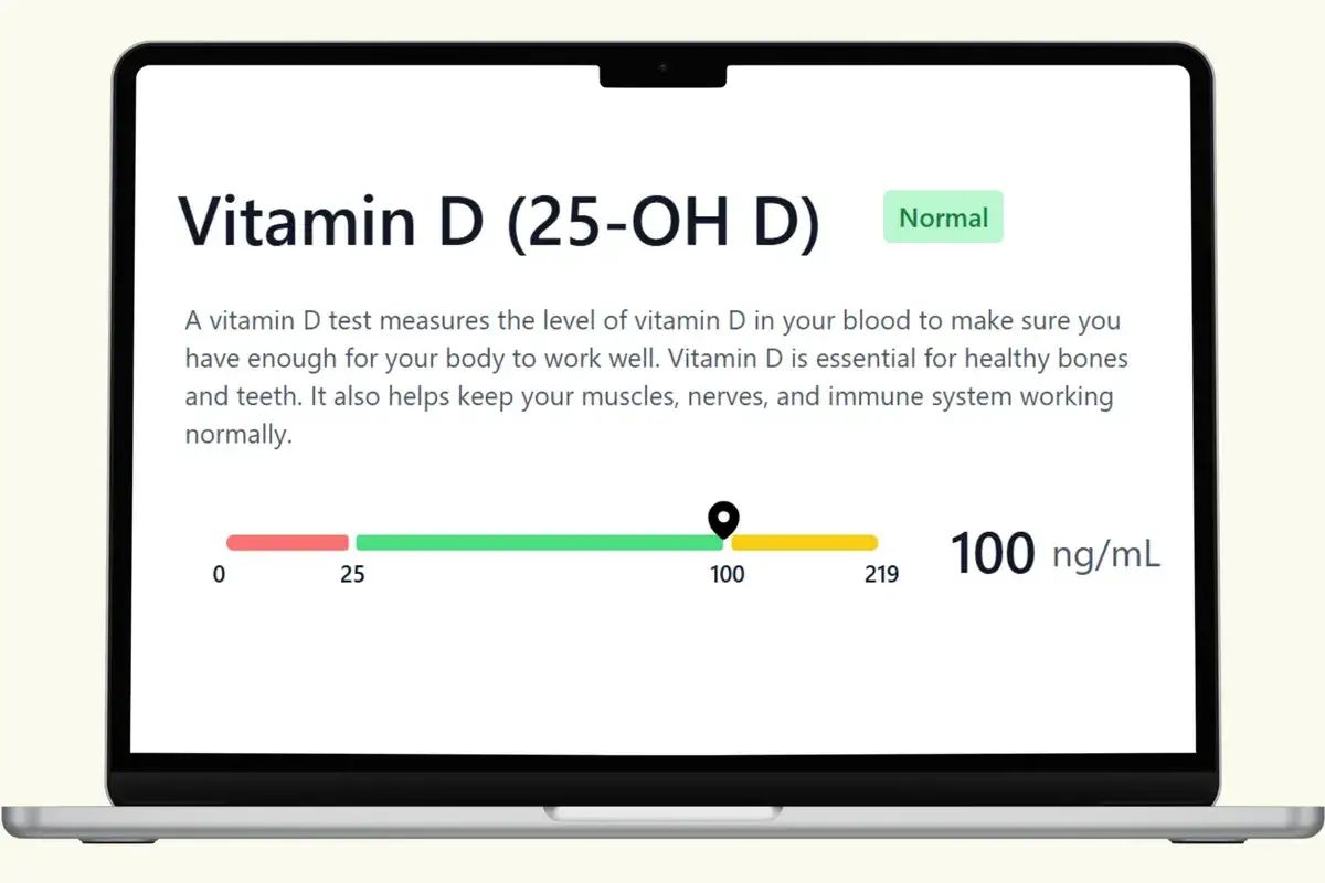 Vitamin D-Test zeigt 100 ng/mL an, was