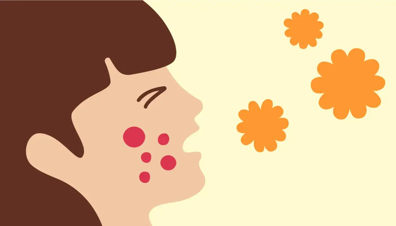 Ansikts profil med utslag, som nyser mot orange blommor. Kanske en hyacint allergi?