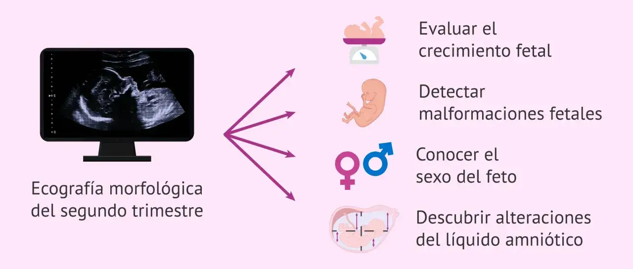 Ecograf&iacute;a morfol&oacute;gica del segundo trimestre, ideal para la semana 19 de embarazo. Eval&uacute;a crecimiento, detecta malformaciones, conoce el sexo y l&iacute;quido amni&oacute;tico.