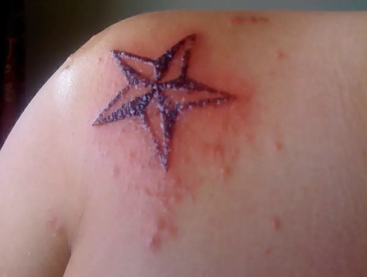 Tatouage étoile rouge et enflammé, signes d'une infection tatouage que faire ? Consulter un médecin.