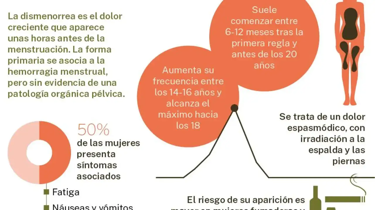 El dolor de ovarios antes de la regla, o dismenorrea, afecta al 50% de las mujeres. Se describe como un dolor espasm&oacute;dico que irradia a espalda y piernas.