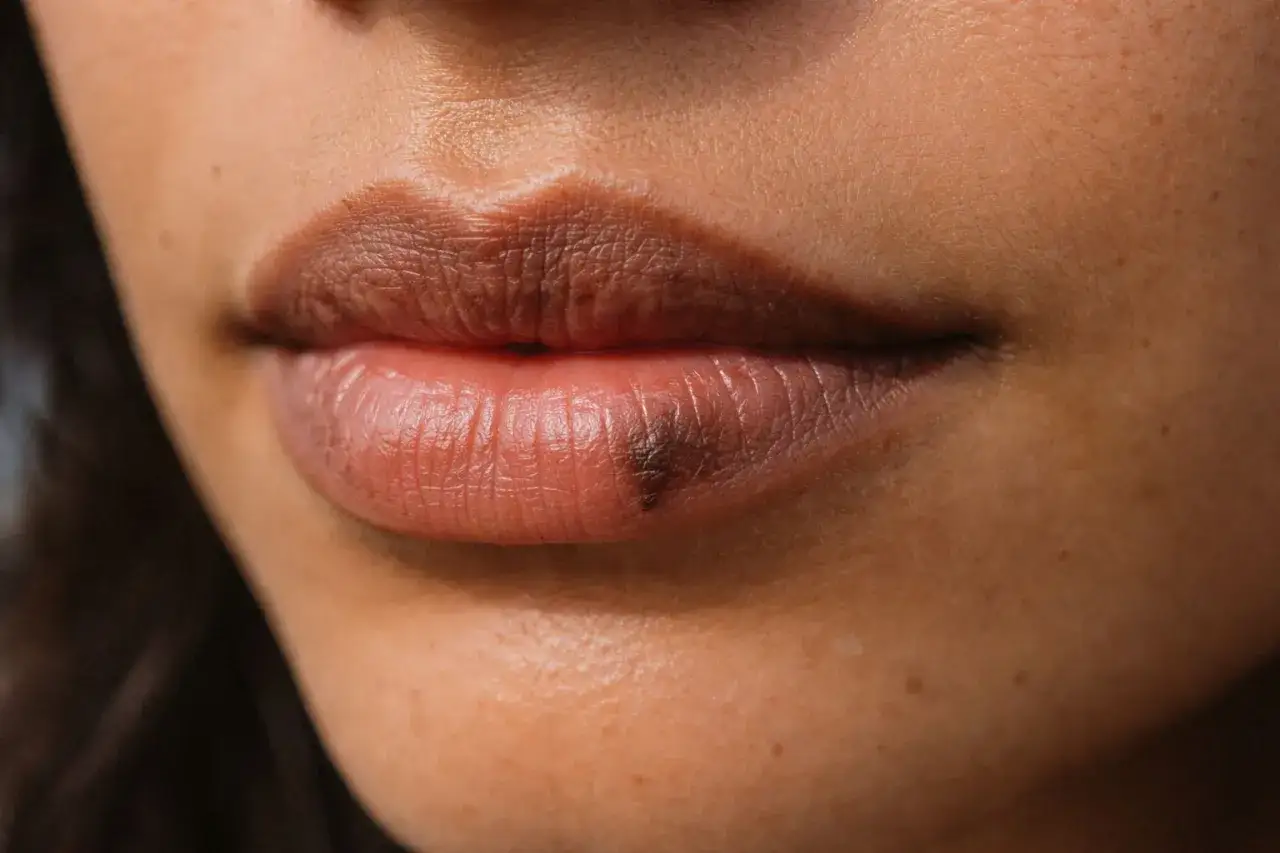 Primer plano de unos labios con una mancha oscura en el labio inferior, que parece una peca o lunar.