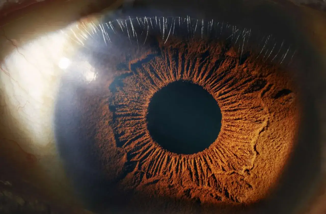 Zbliżenie na brązową tęczówkę oka, gdzie widoczna jest heterochromia.