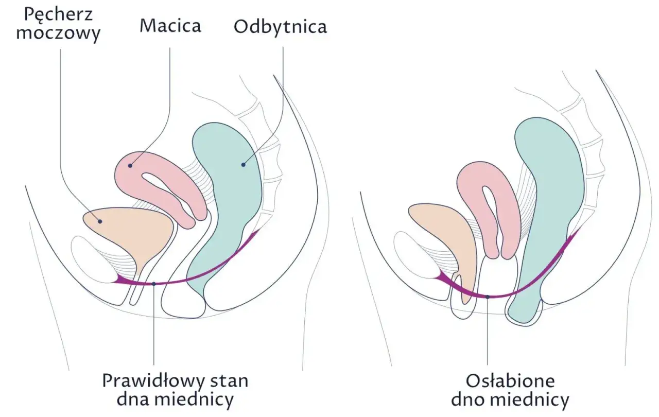 Kobieta w ciąży, kobieta w średnim wieku, ilustracja dna miednicy