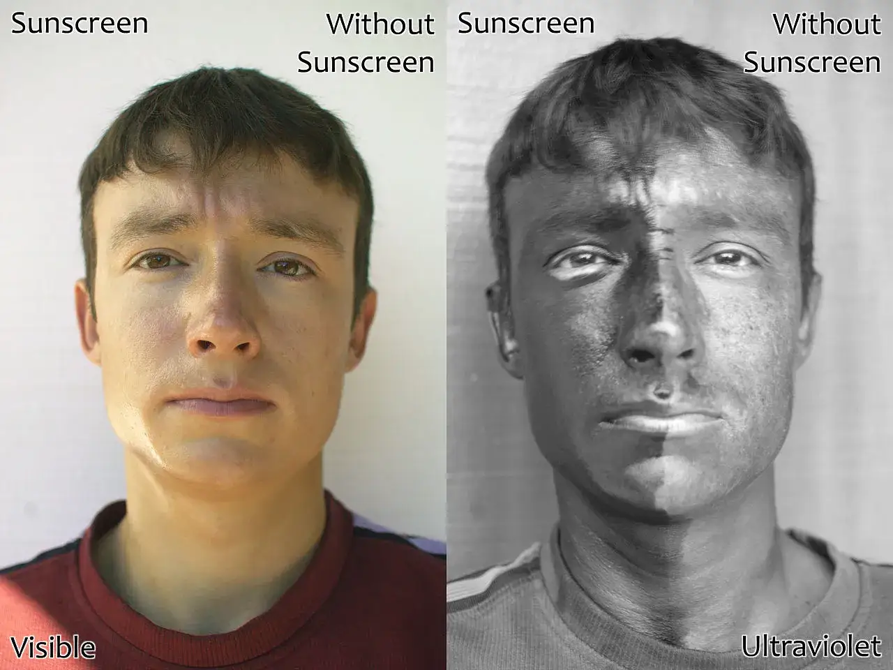 Vergleich: Gesicht mit und ohne Sonnencreme unter UV-Licht. Die linke Hälfte zeigt das sichtbare Ergebnis, die rechte die unsichtbare Schutzschicht.