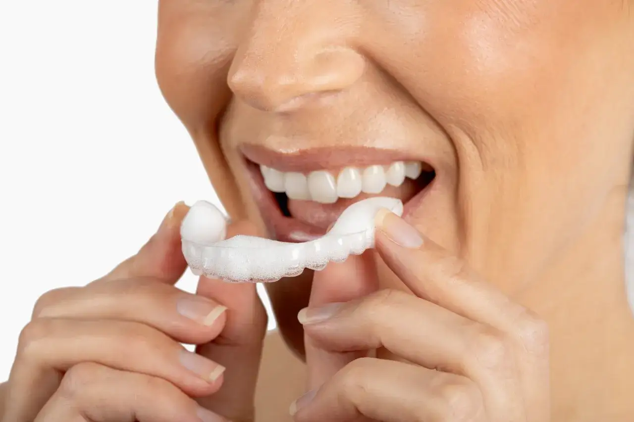 Mujer sonriendo mientras se aplica espuma para blanquear Invisalign.