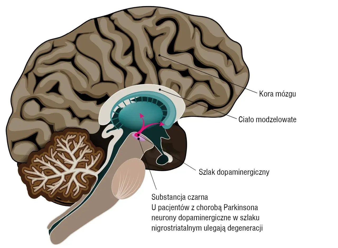 Schemat mózgu pokazujący szlak dopaminergiczny. U pacjentów z chorobą Parkinson neurony w substancji czarnej ulegają degeneracji, co prowadzi do parkinsonizmu.