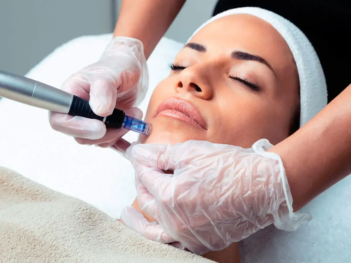Una esteticista realiza mesoterapia con dermapen en el rostro de una mujer, promoviendo la regeneración de la piel.