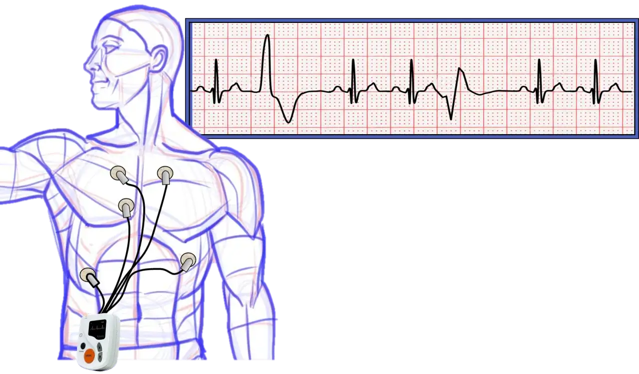 Elektrokardiogram (EKG) pokazuje rytm serca. Czy arytmia serca jest śmiertelna? EKG pomaga to ocenić.