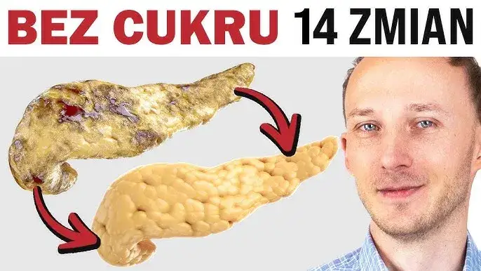 Zdjęcie Jak skutecznie i bezbolesnie rzucić cukier?