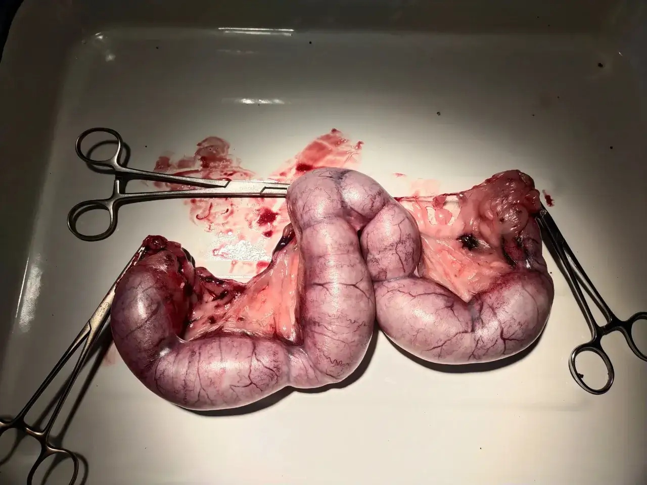 Usunięte narządy rodne suki podczas cieczki, z widocznymi naczyniami krwionośnymi. Narządy są utrzymywane przez kleszczyki chirurgiczne.