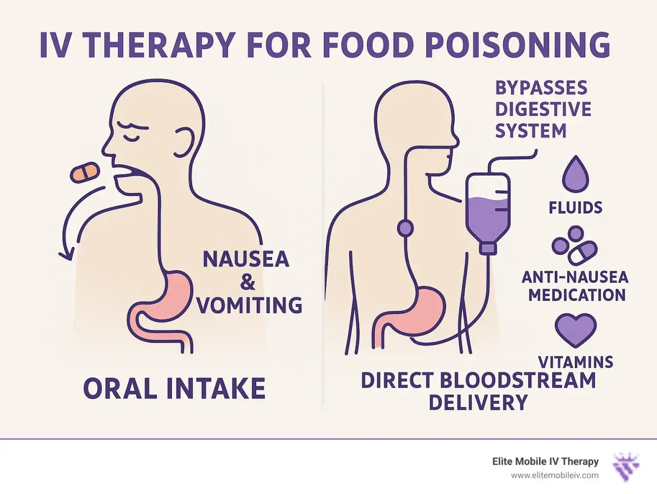 Comparaison de l'apport oral (nausées, vomissements) et de la thérapie IV pour l'intoxication alimentaire : traitement direct par perfusion.