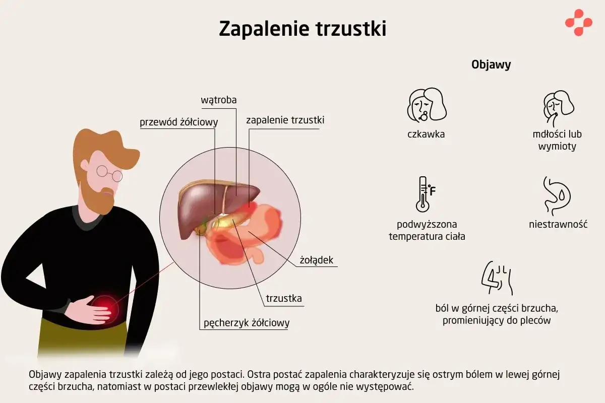 Ilustracja przedstawia objawy zapalenia trzustki: ból brzucha, mdłości, gorączkę i niestrawność.