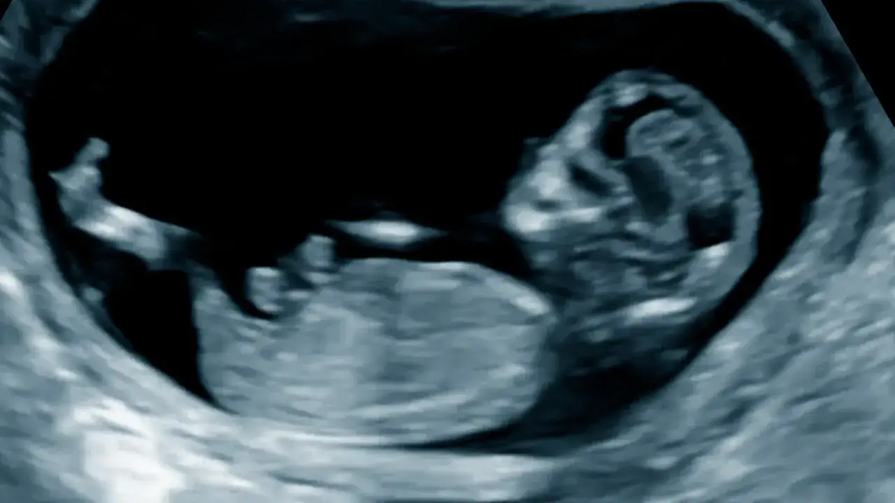 Ultraljudsbild visar ett foster, gravid v12. Man kan se huvud, kropp och armar.