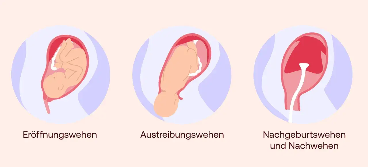 Drei Phasen der Geburt: Er&ouml;ffnungswehen, Austreibungswehen und Nachgeburtswehen. Bald ist es soweit!
