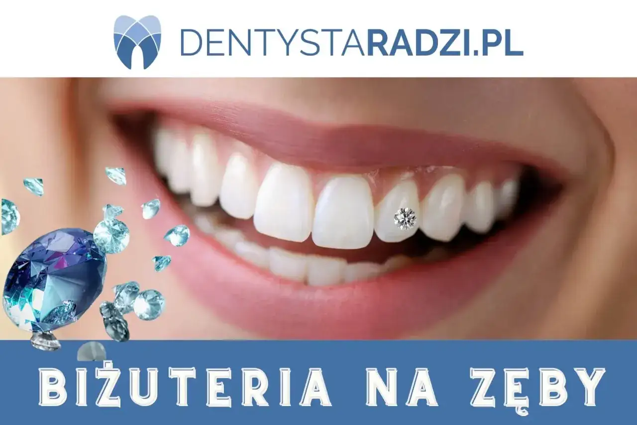 Dowiedz się, ile kosztują kryształki na zęby i biżuteria na zęby. Uśmiech z błyszczącym diamentem.