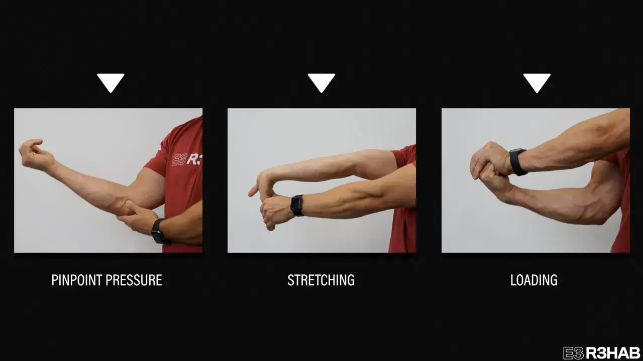 Esercizi per epitrocleite: pressione mirata, stretching e carico del braccio.