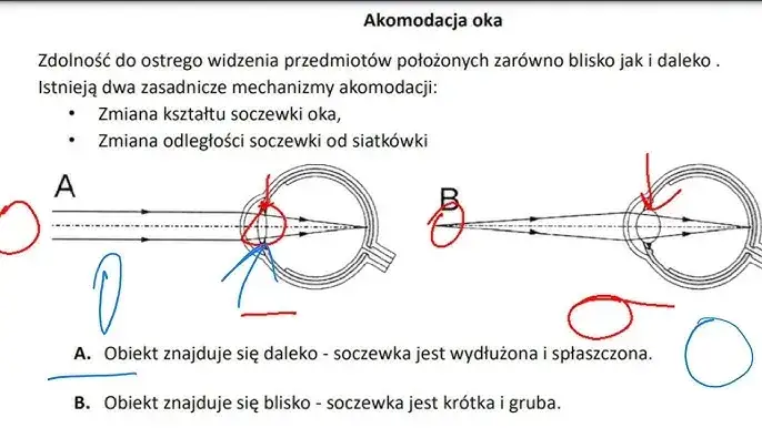 dalekowzroczność mechanizm oko schemat