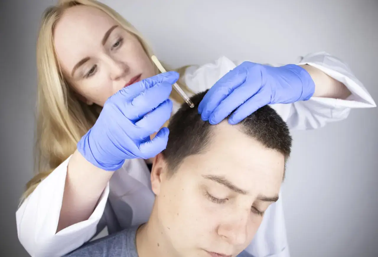 Lekarz od włosów aplikuje serum na skórę głowy pacjenta.