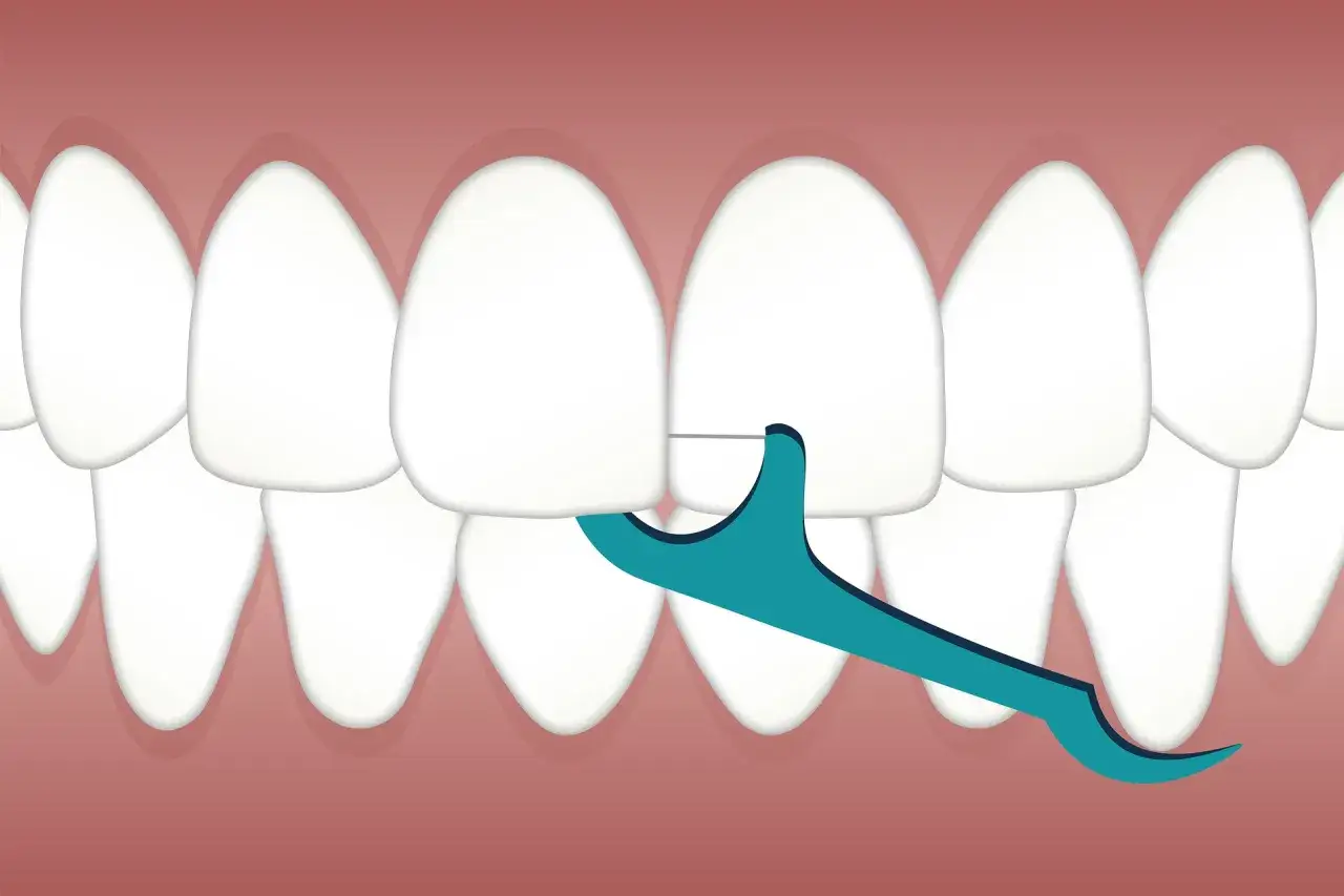 Un filo interdentale cerato pulisce tra i denti bianchi, mostrando un'igiene orale impeccabile.