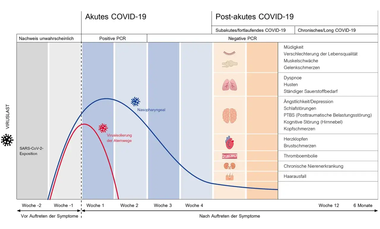 Schema zeigt den Verlauf von COVID-19, mit Symptomen wie Husten und Atemnot, die auch nach der akuten Phase auftreten können, was auf ein mögliches asthma nach corona hindeutet.