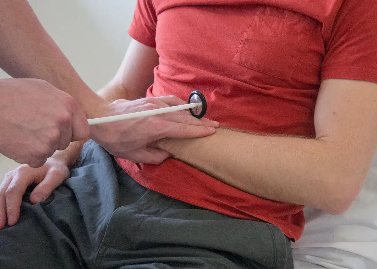 Arzt testet Reflexe am Arm eines Mannes mit einem Reflexhammer. Der Hoffmann-Tinel-Test wird durchgeführt.