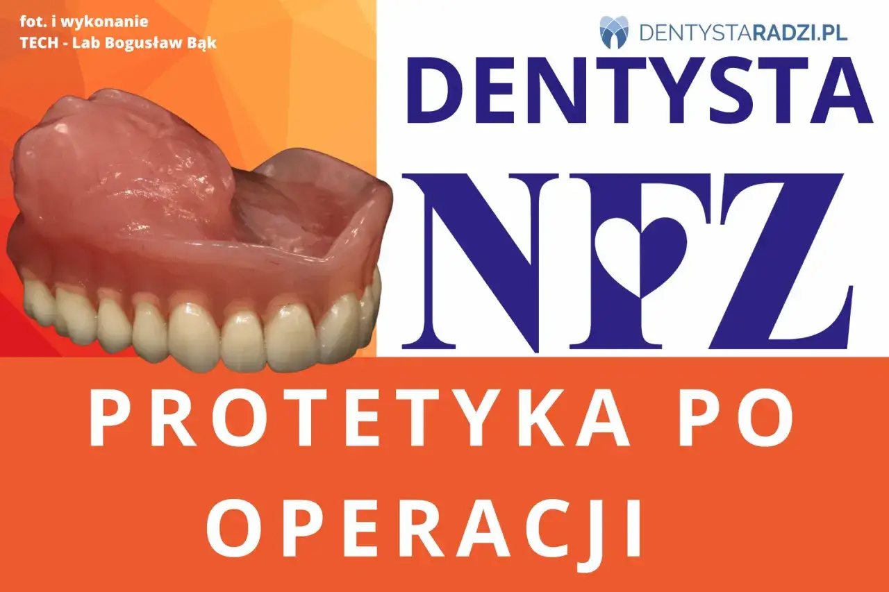 Protezy zębowe NFZ – nowe zęby za darmo po operacji. Dentyści radzą.