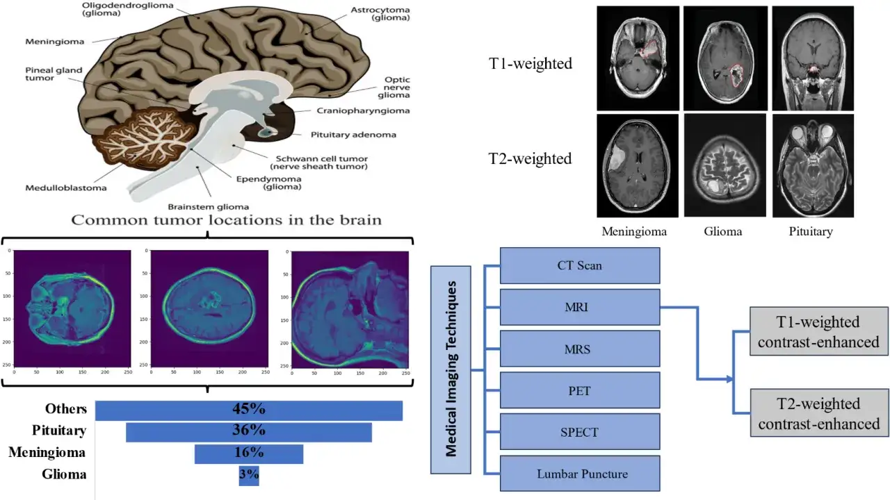 Ilustracja przedstawia lokalizacje guzów mózgu, obrazy MRI różnych typów guzów (meningioma, glioma, pituitary) oraz metody diagnostyczne.