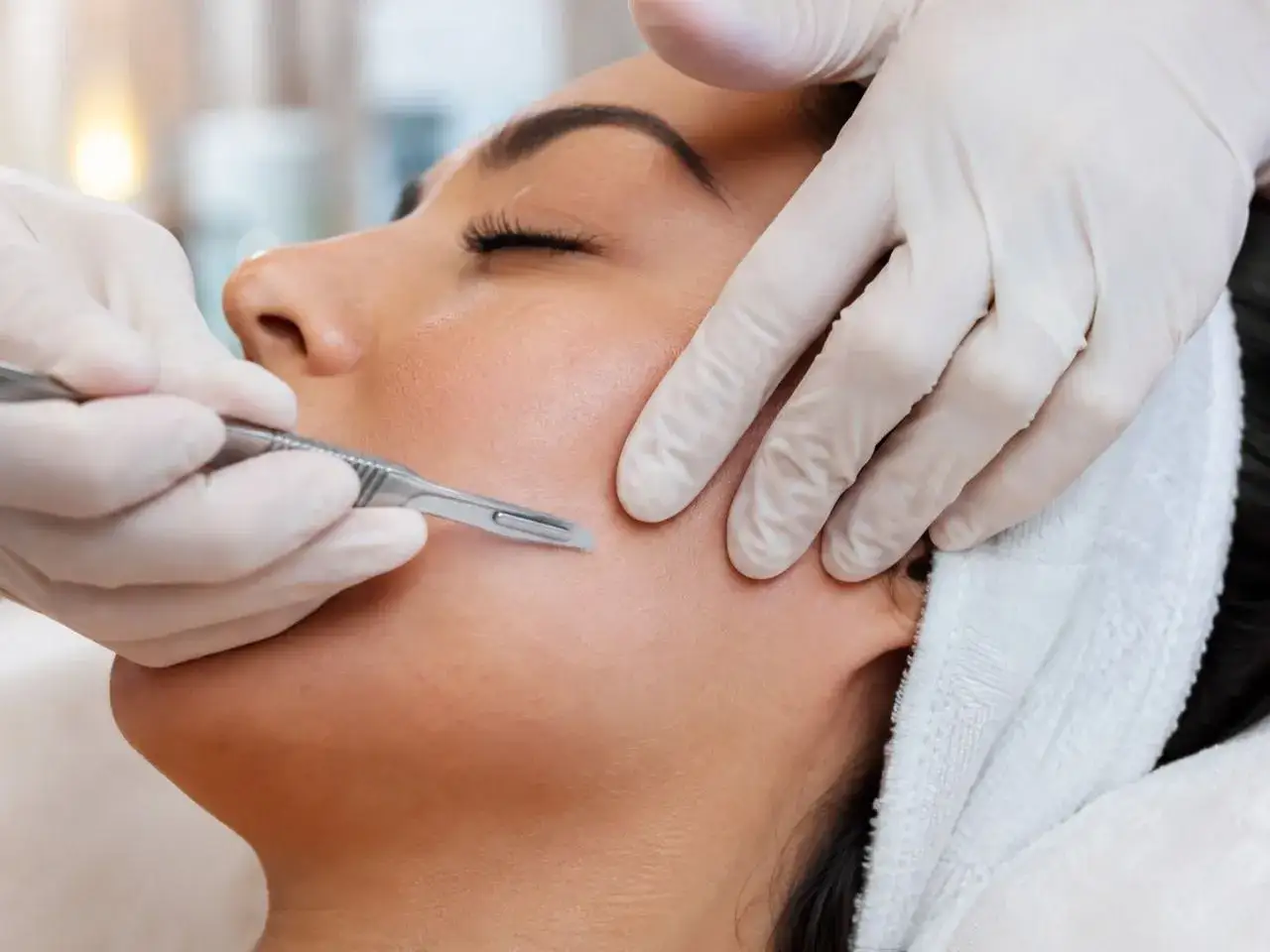 Dermaplaning co to? Zabieg usuwania martwego naskórka i meszku za pomocą skalpela. Skóra staje się gładsza i jaśniejsza.