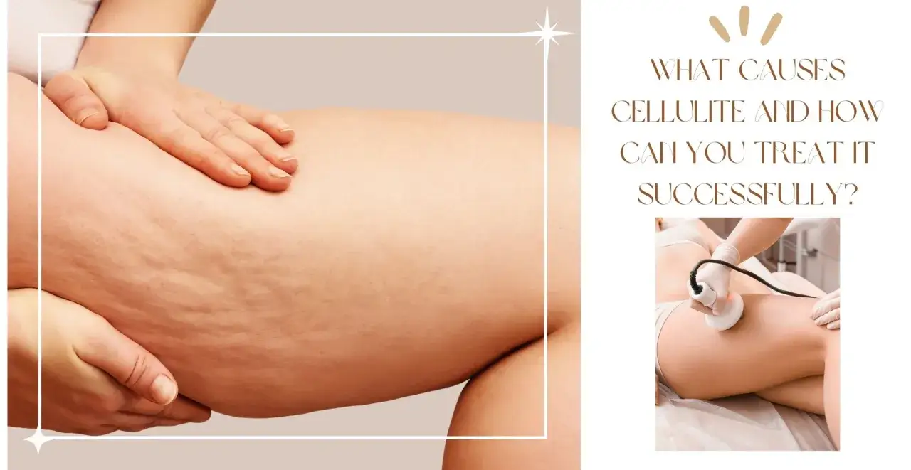 Nahaufnahme von Oberschenkeln mit Cellulite, daneben eine Behandlung. Erfahren Sie, wie entsteht Cellulite und wie man sie erfolgreich behandelt.