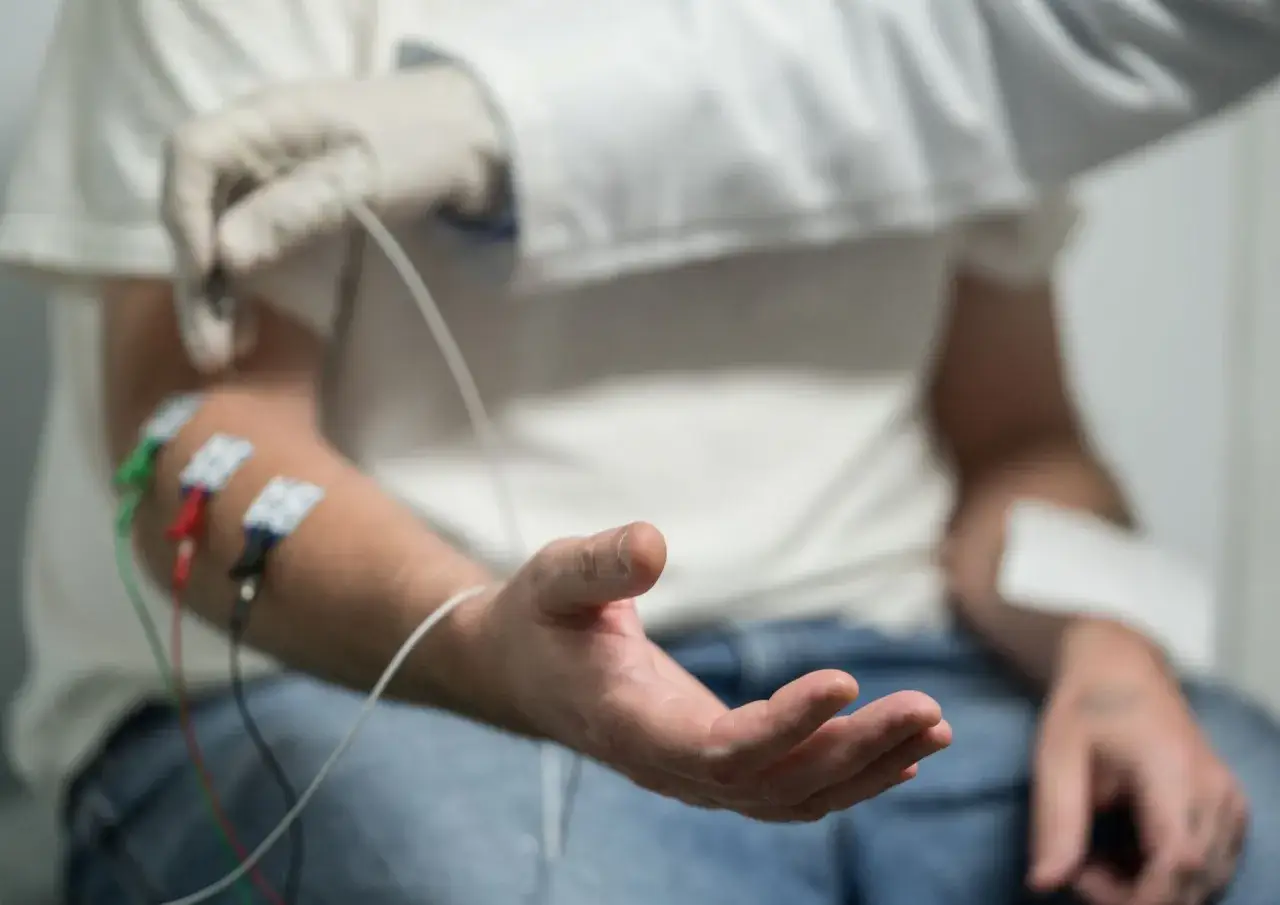 Badanie EMG, co to jest? Elektromiografia ocenia funkcje nerwów i mięśni. Na ramieniu pacjenta widać elektrody.
