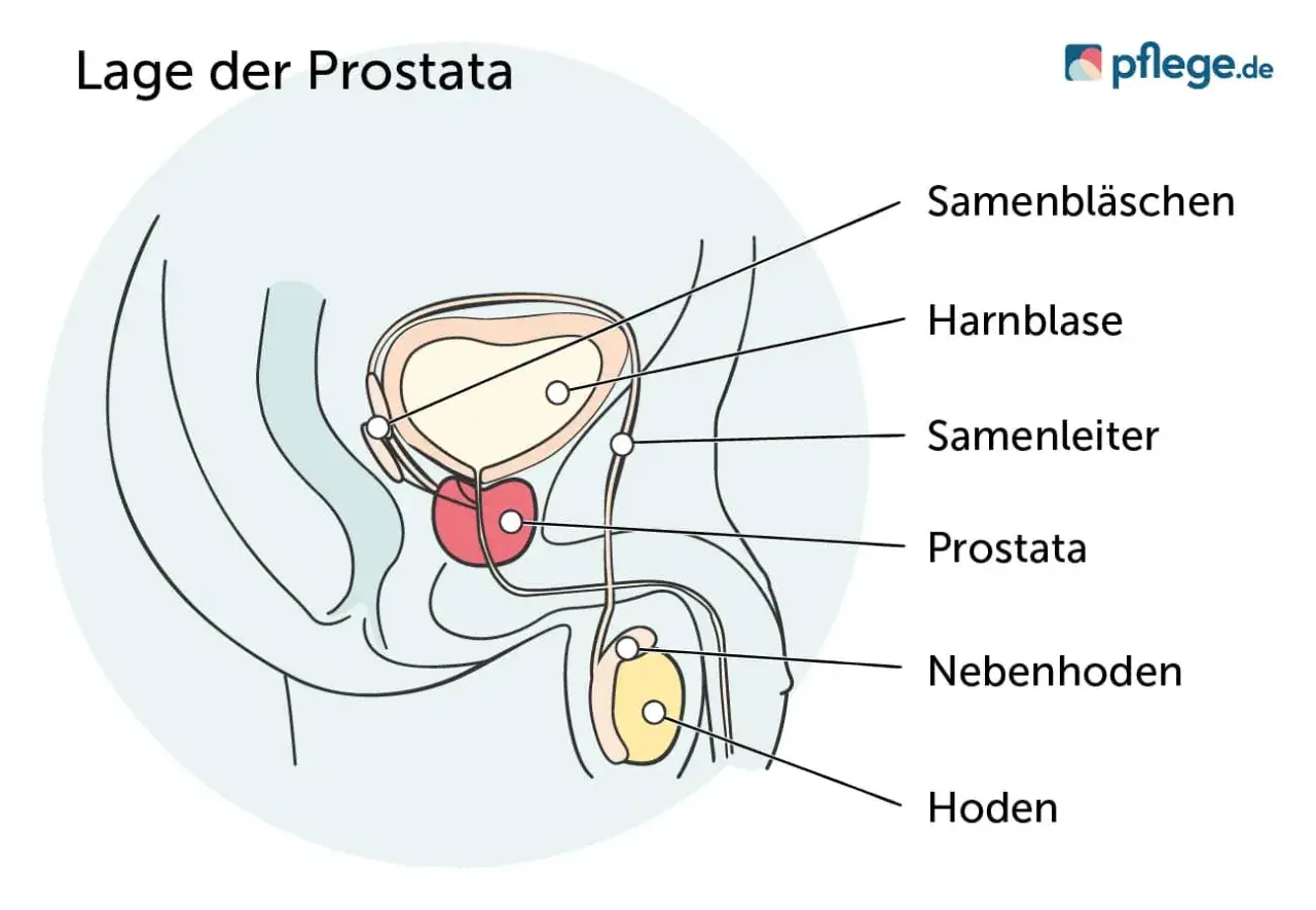 Anatomische Darstellung der Prostata, Harnblase, Samenbläschen, Samenleiter, Hoden und Nebenhoden. Wichtige Informationen zu Prostatakrebs Symptomen.