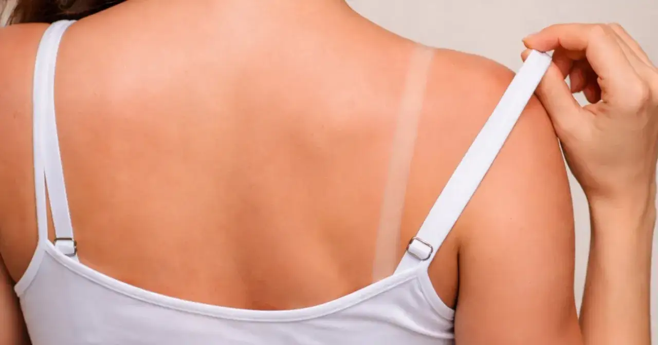 Un segno del reggiseno sulla pelle abbronzata, ricordo di una giornata al sole.