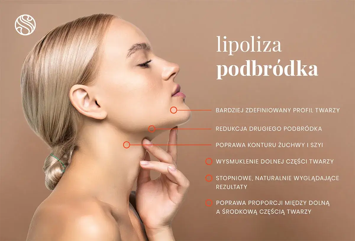 Profil kobiety z zaznaczonym drugim podbródkiem, który można zredukować dzięki lipolizie. Poprawa konturu żuchwy i szyi.