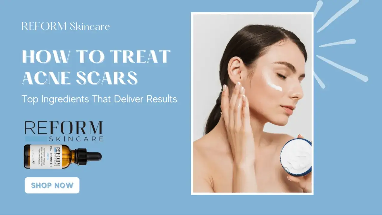Kobieta aplikuje krem na twarz, by zwalczyć przebarwienia po trądziku. Reklama serum Reform Skincare.