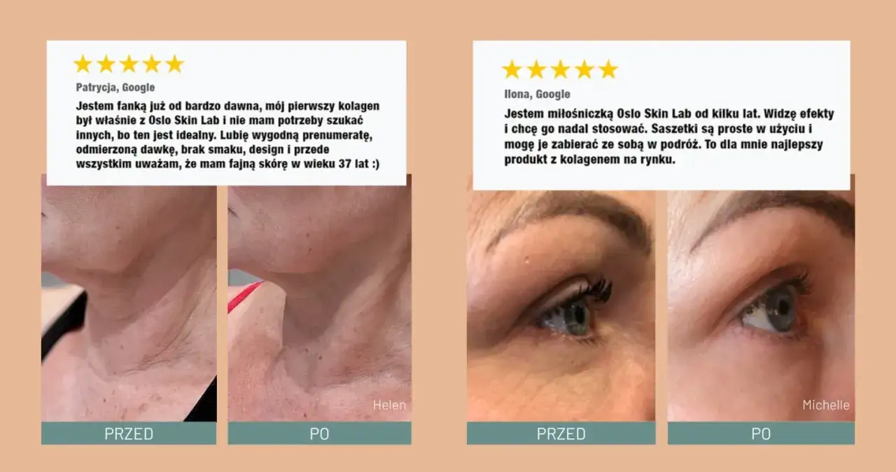 Oslo Skin Lab opinie: Patrycja i Ilona chwalą kolagen za efekty i wygodę. Zdjęcia pokazują poprawę skóry.