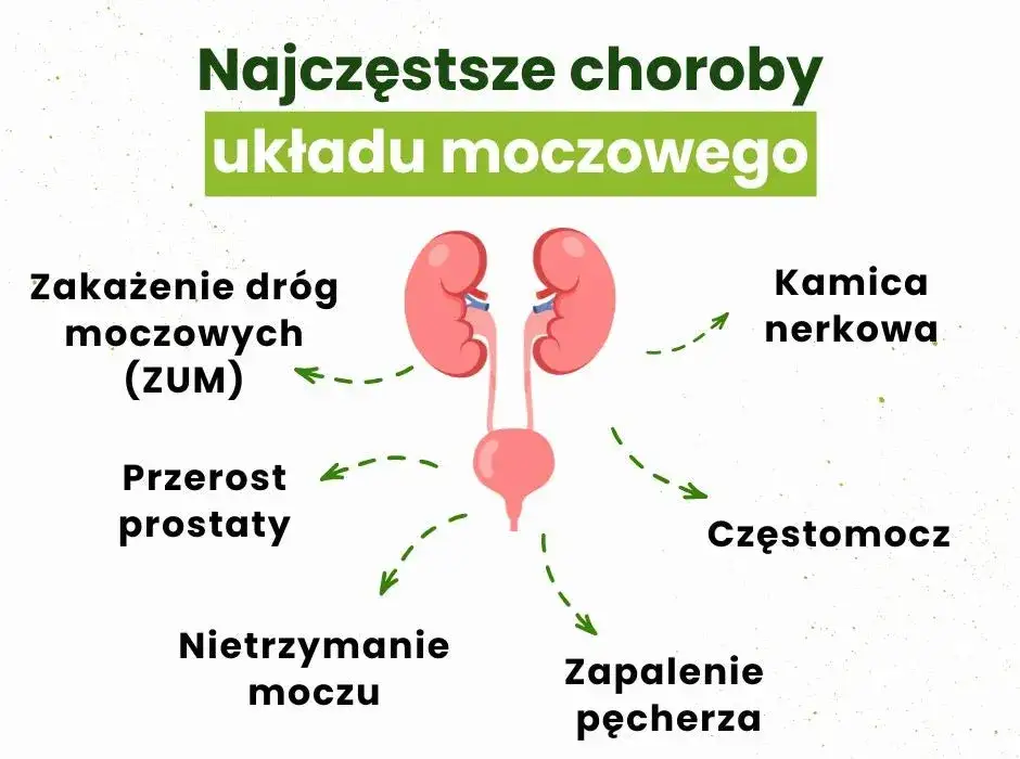 Objawy chorób układu moczowego