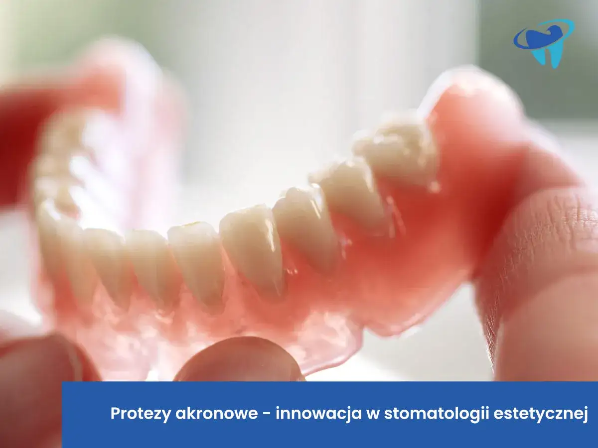Protezy akronowe – innowacja w stomatologii estetycznej. Sprawdź, jaka jest proteza akronowa cena i odzyskaj piękny uśmiech.