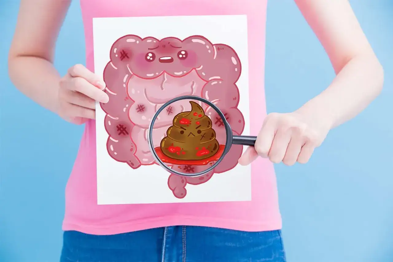 Ilustracja jelit z powiększoną kupką. Czy to czerwony stolec po burakach?