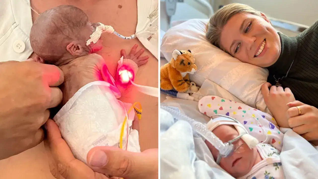 En nyfödd bebis, som om den vore gravid vecka 27, vårdas med kärlek. Bredvid ligger en glad mamma med sin lilla.