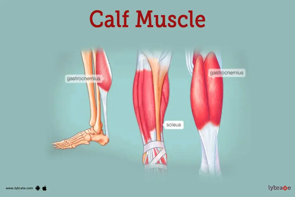 Ilustraci&oacute;n anat&oacute;mica del gemelo, mostrando las fibras musculares del gastrocnemio y el s&oacute;leo.