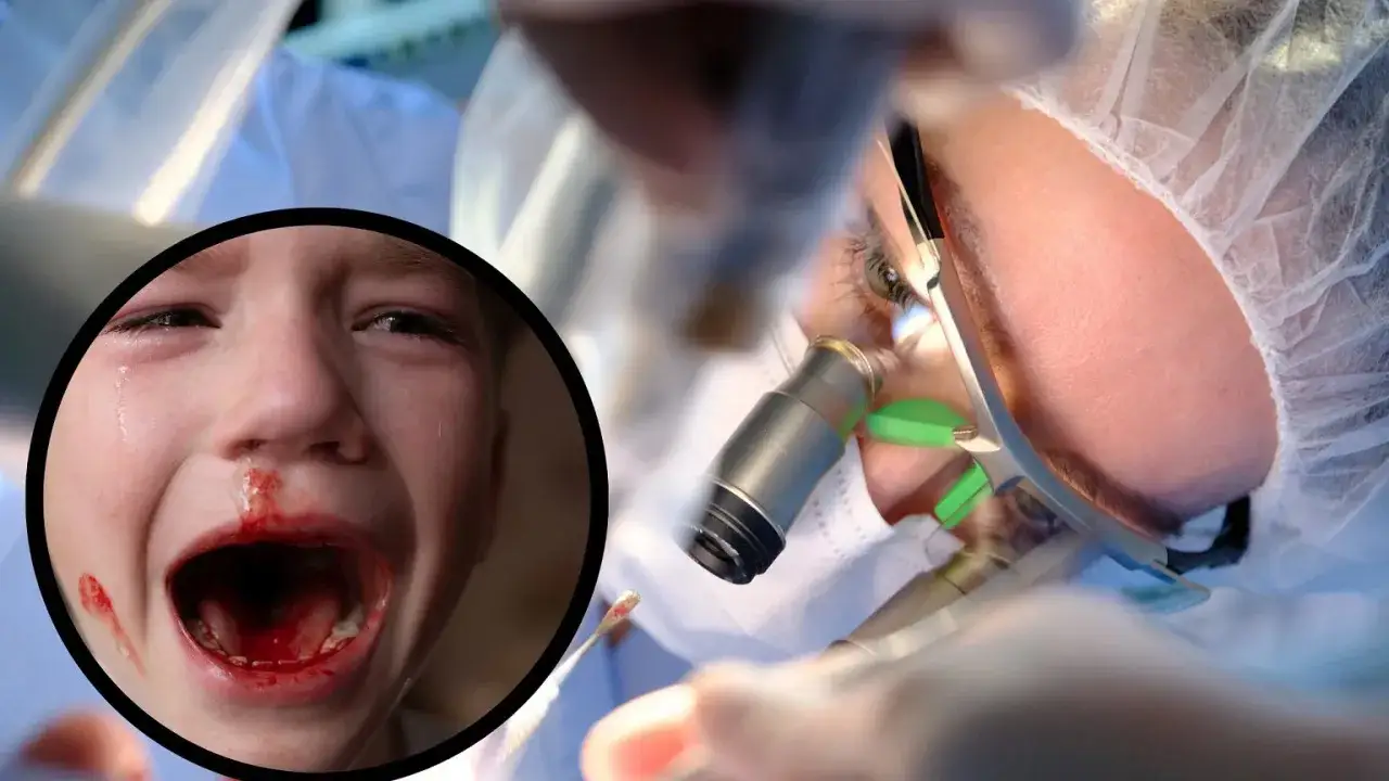 Płacz dziecka z krwią wokół ust, podczas gdy dentysta bada jego ząb. Czy ząb mleczny ma korzeń?