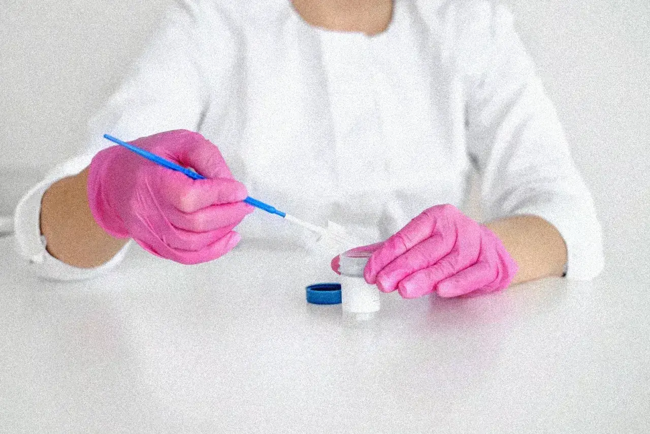 Ręce w różowych rękawiczkach przygotowują próbkę do badania cytologicznego. Czas oczekiwania na wynik cytologii bywa stresujący.