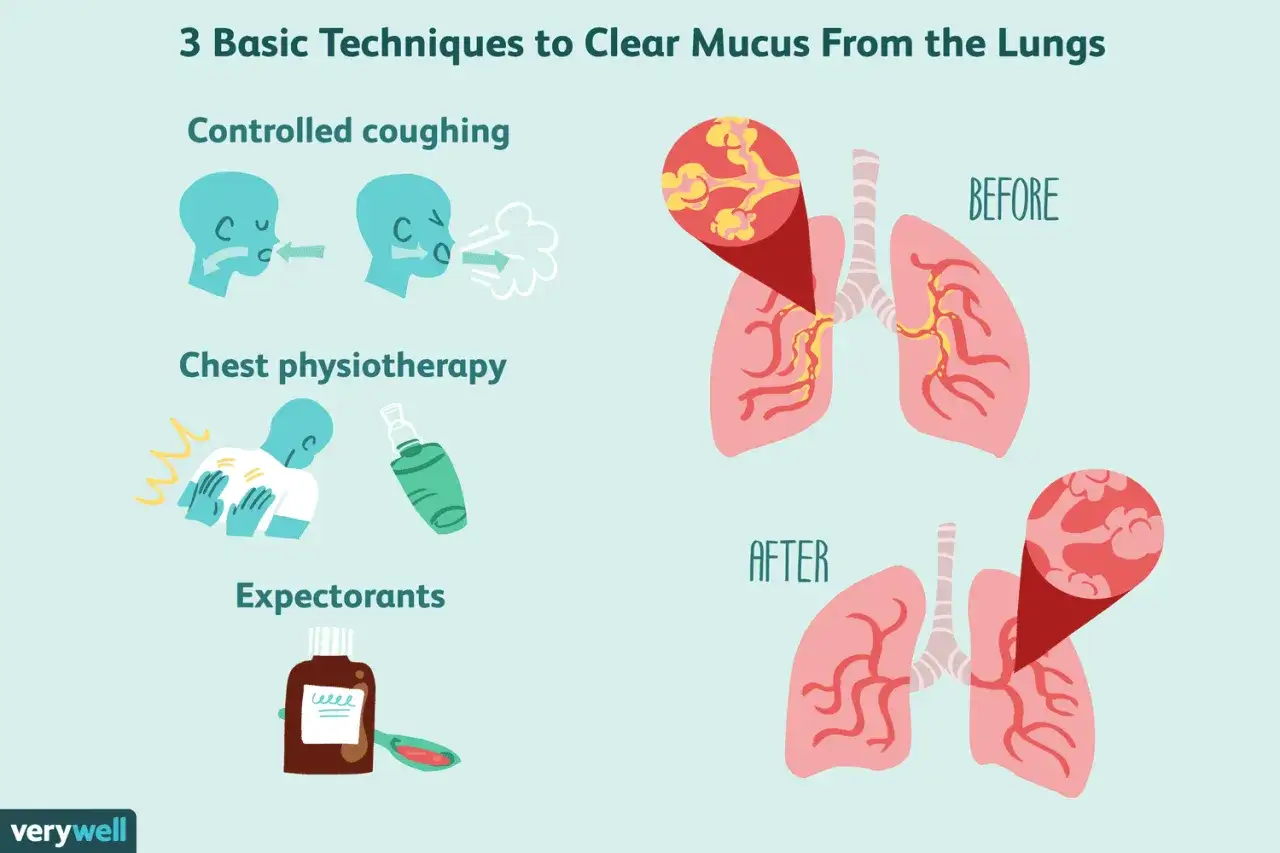 Techniques pour comment dégager les bronches du mucus : toux contrôlée, kinésithérapie thoracique, expectorants. Avant/après : poumons encombrés puis dégagés.