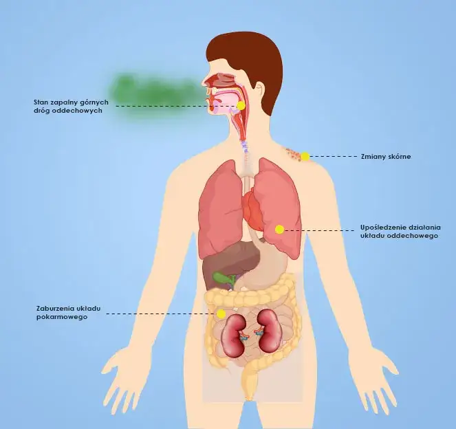 Objawy neurologiczne alergii